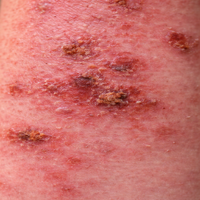 옵션 0원 테스트